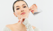 Hướng dẫn cách trị mụn cấp tốc đón Giáng sinh