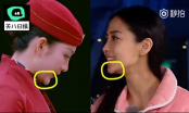 'Tình địch của Dương Mịch' lộ cằm gẫy - di chứng phẫu thuật thẩm mỹ?