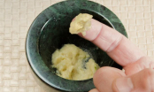 Đau răng đến mấy cũng chỉ cần thoa thứ nước này lên cũng khỏi ngay trong chớp mắt không cần thuốc tây