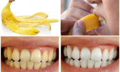Đánh bật cao răng lâu năm, dày bám chắc cỡ nào cũng hết chỉ với 1 ngàn đồng
