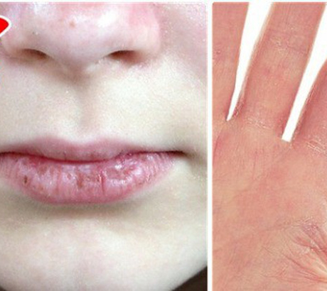 10 dấu hiệu lão hóa, phụ nữ phải đối diện khi ngoài 30