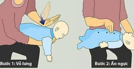 Bí quyết chữa bé bị sặc cháo cha mẹ nào cũng cần phải biết