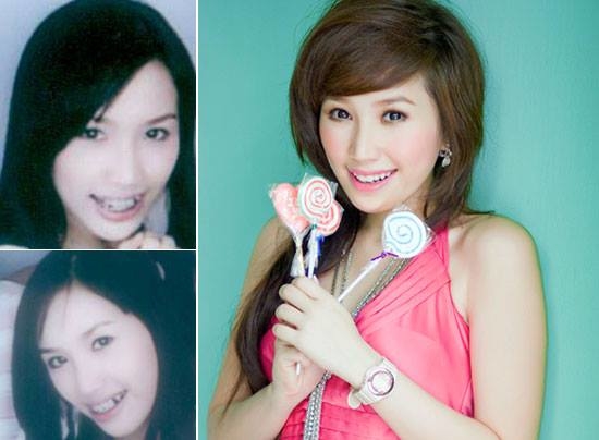 Những thước ảnh quá khứ khiến Bảo Thy phải nhận rất nhiều ý kiến trái chiều rằng nhan sắc đã từng can thiệp