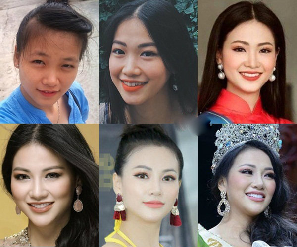 Từ thiếu nữ kém sắc, Phương Khánh lột xác xinh đẹp trở thành Hoa hậu Trái đất mang theo nghi án phẫu thuật thẩm mỹ.    