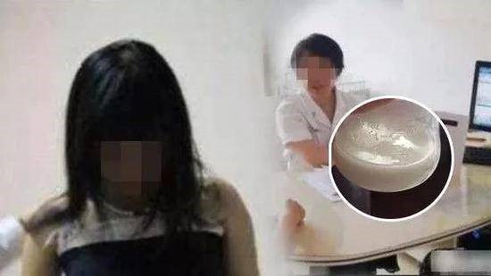 Cô gái ngực tiết ra sữa vì uống thuốc giảm cân.