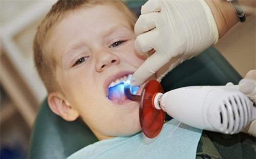 Nên cho trẻ đi khám răng định kỳ dù bé không đau