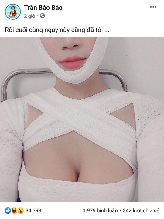 Bức ảnh được BB Trần chia sẻ trên trang cá nhân khiến công chúng không khỏi hoang mang.