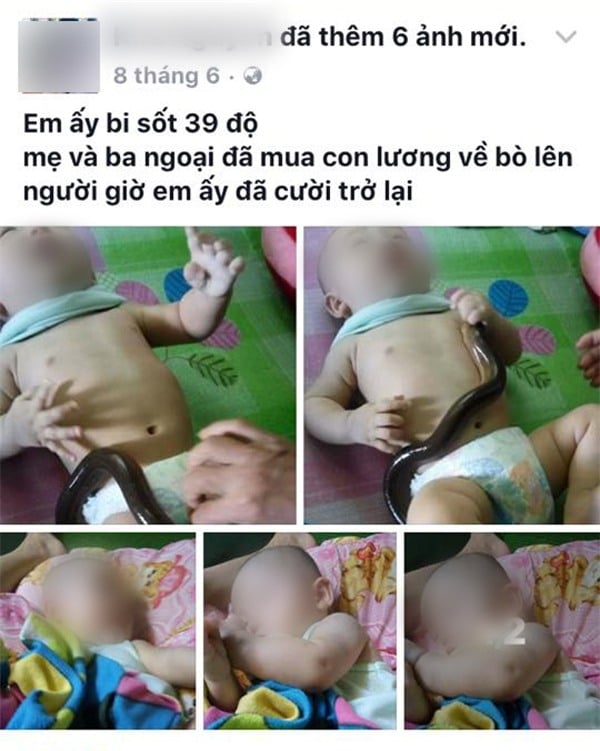 Hạ sốt bằng lươn không an toàn cho bé