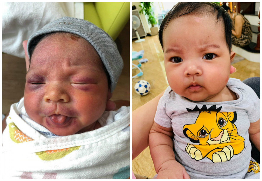 Bức hình KiO lúc mới sinh và sau đó 3 tháng