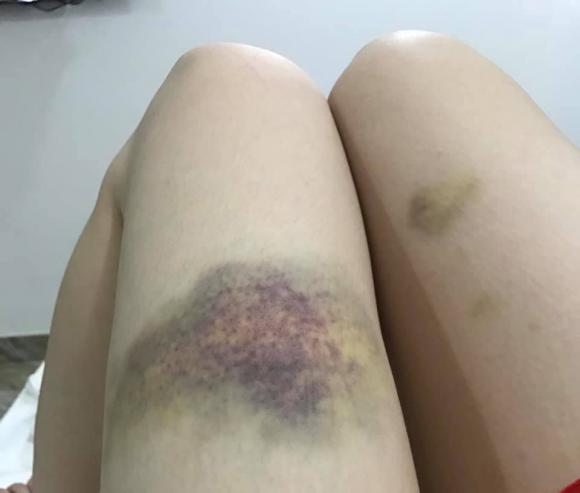 Nhìn loạt ảnh Nhật Kim Anh ‘ăn bờ ngủ bụi’, người ngợm trầy trật mới thấy nghệ sĩ cơ cực nhường nào.