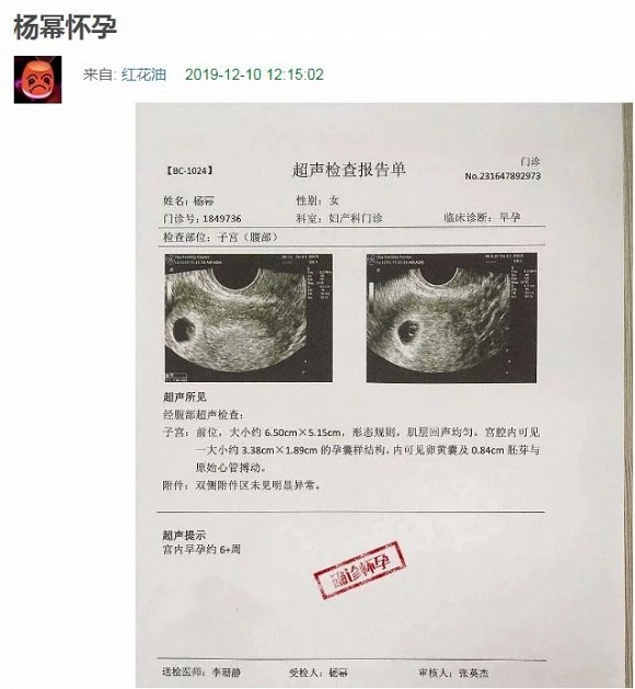 Tờ giấy khám thai có tên Dương Mịch được lan truyền trên mạng xã hội sau thông tin cô và Ngụy Đại Huân lén lút vào chung khách sạn.  
