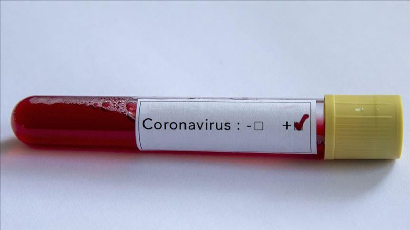 Hà Lan ghi nhận ca nhiễm Covid-19 đầu tiên sau khi trở về từ Italy. Ảnh minh họa: Anadolu