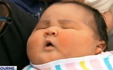 Bé gái nặng 6.6kg chào đời bằng phương pháp sinh thường