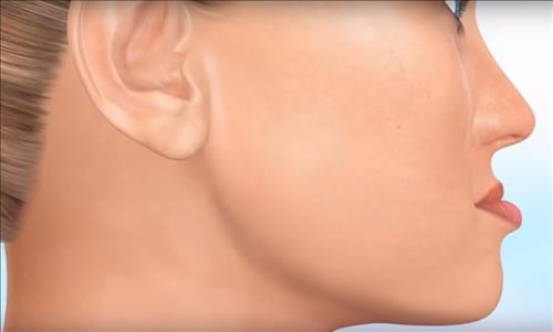 Tướng mặt lưỡi cày