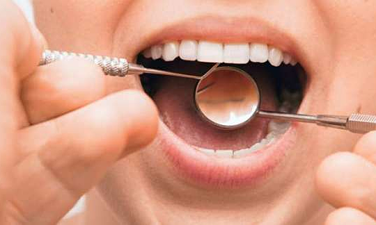 Dấu hiệu răng miệng của bạn đang gặp vấn đề