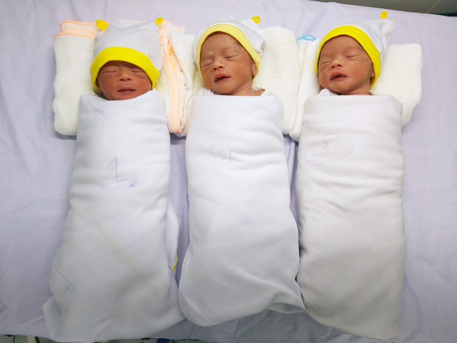 Ca sinh 3 hiếm gặp tại Bệnh viện Sản-Nhi An Giang.