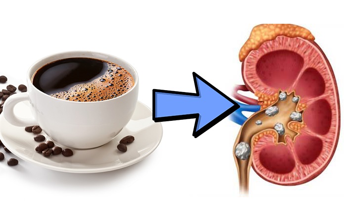 Uống cà phê khi bụng trống rỗng sẽ không tốt cho dạ dày, gan thận