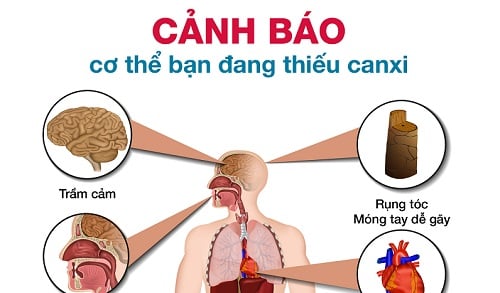 Những biểu hiện cơ thể bạn đang thiếu canxi