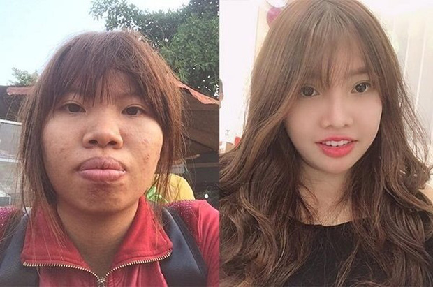 Nhan sắc trước và sau phẫu thuật thẩm mỹ (Nguồn ảnh tổng hợp)