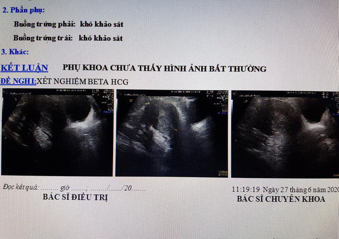 Kết qủa siêu âm cho thấy chị D. hoàn toàn không có thai (Ảnh: Bác sĩ cung cấp)