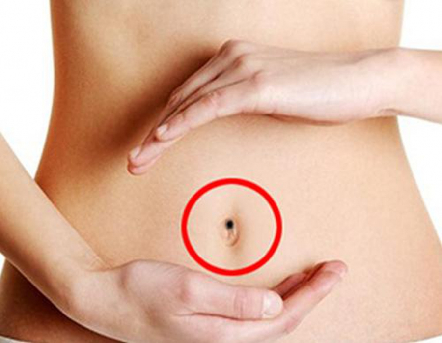 Phu nữ có nốt ruồi ở giữa rốn may mắn