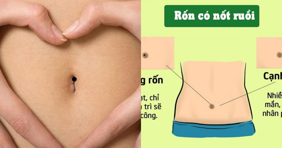 Nốt ruồi vùng rốn hút tài lộc