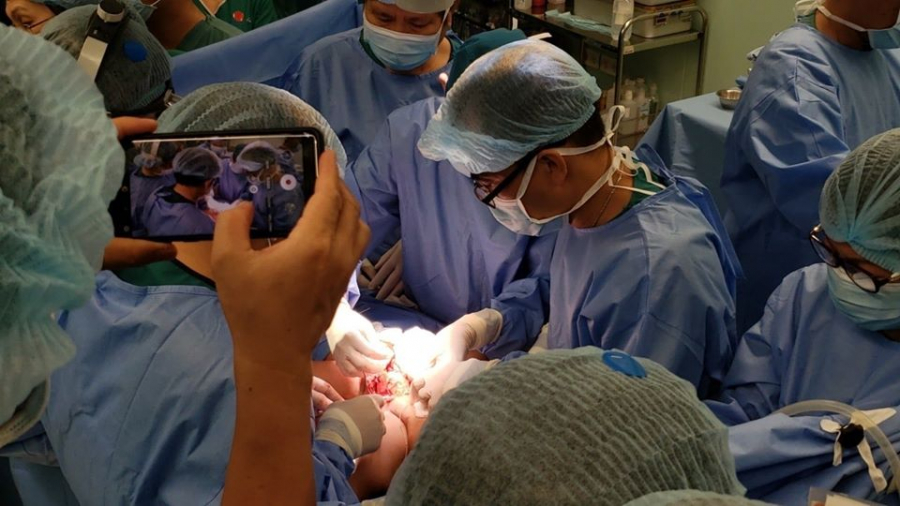 Cuộc phẫu thuật kỳ diệu với nỗ lực không ngừng nghỉ của các y bác sĩ (Ảnh: Bệnh viện Nhi đồng Thành phố)