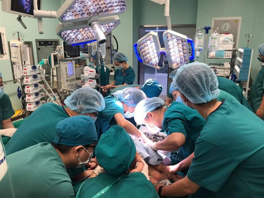 Gần 100 y bác sĩ phối hợp tiến hành ca phẫu thuật kéo dài 12 tiếng cho cặp song sinh (Ảnh: Bệnh viện Nhi đồng Thành phố)