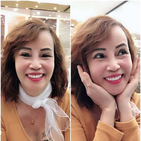 Cô dâu 62 tuổi đã không ngần ngại bỏ số tiền lớn để tắm trắng và phẫu thuật hút mỡ cấy mu bàn tay, hút mỡ bụng
