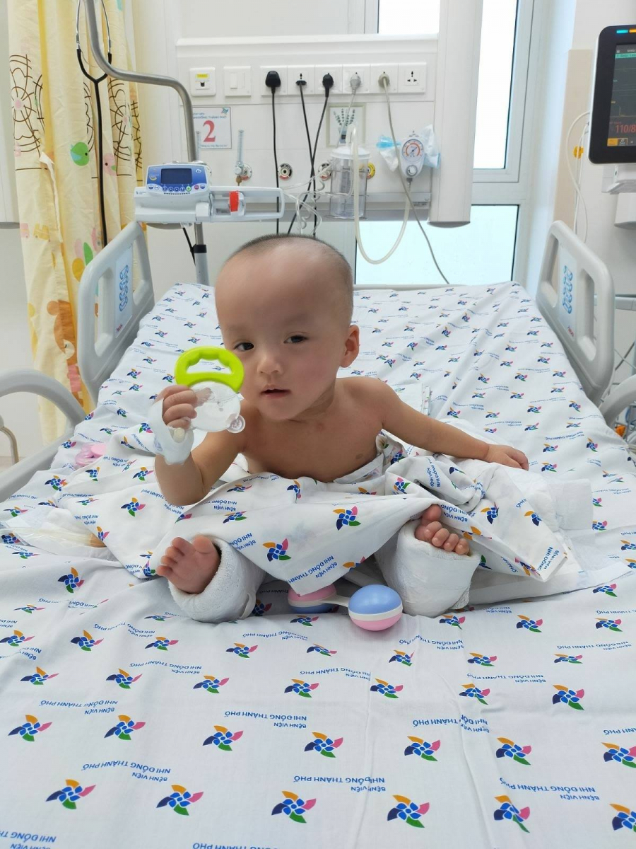 Trúc Nhi - Diệu Nhi sinh ngày 6/7/2019 tại Bệnh viện Hùng Vương TP.HCM, là hai bé gái song sinh dính liền phức tạp. Sau khi sinh mổ thành công, các bác sĩ tại BV Nhi đồng Thành phố đã tiến hành theo dõi, chăm sóc các bé theo một chế độ đặc biệt.    