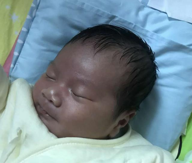 Bé sơ sinh có làn da đen xì khiến mẹ tưởng con bị