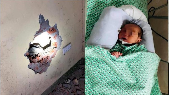 Bé sơ sinh bị bỏ rơi ở vách tường hiện đang được điều trị tại Bệnh viện Đa khoa Xanh Pôn - Ảnh: Báo Đại Đoàn Kết.