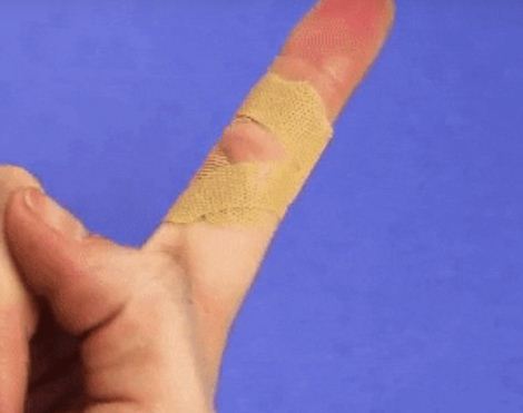Đối với những vết thương ở giữa ngón tay, bạn dán chéo miếng urgo về phía hai sẽ giúp khớp tay dễ dàng cử động hơn.