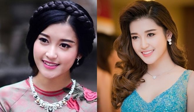 Dàn mỹ nhân Việt lên đời nhan sắc nhờ vào chỉnh lại hàm răng - ảnh 2