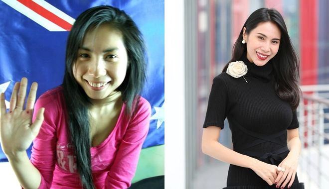 Dàn mỹ nhân Việt lên đời nhan sắc nhờ vào chỉnh lại hàm răng - ảnh 4