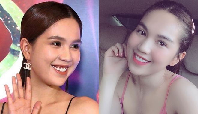 Dàn mỹ nhân Việt lên đời nhan sắc nhờ vào chỉnh lại hàm răng - ảnh 3