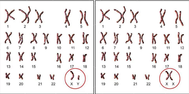 Bảng nhiễm sắc thể của XY của nam (trái) và XX của nữ (phải).