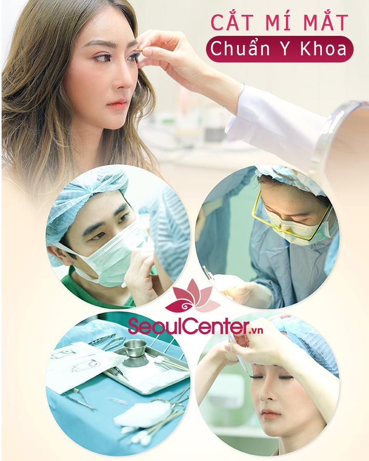 Quy trình cắt mí chuẩn Y Khoa