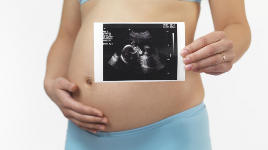 Siêu âm thai mẹ bầu đừng chăm chăm chú ý vào cân nặng, bác sĩ dặn có 4 chỉ số quan trọng hơn nhiều - ảnh 1