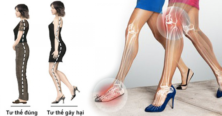 me-di-giay-cao-got-chi-em-u30-can-luu-y-de-tranh-gay-benh-dau-nhuc-xuong-khop-hai-1601002319-417-width1200height628