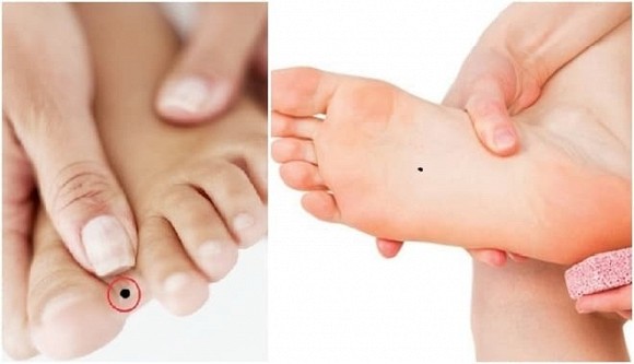 Nốt ruồi ở chân hút tài lộc