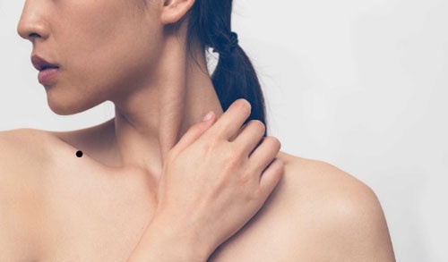 Nốt ruồi vai hút lộc