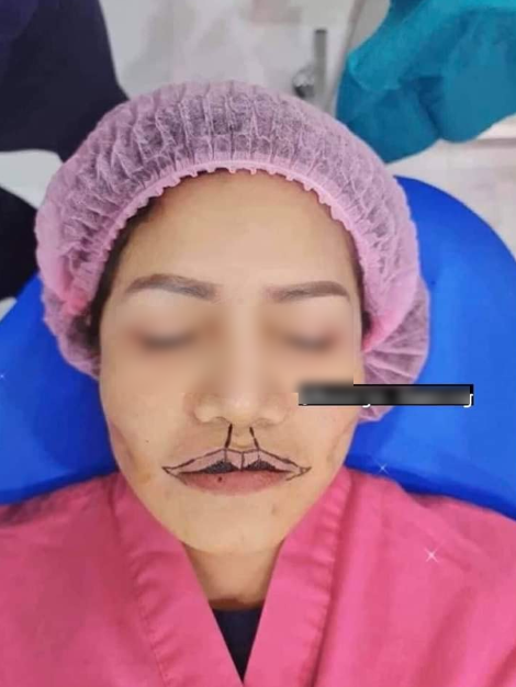 moi_2
