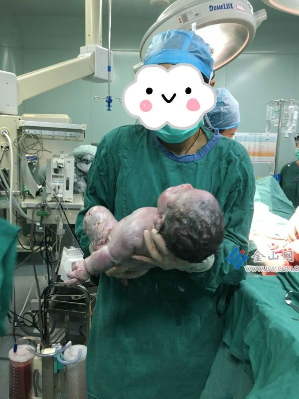 Em bé chào đời với cân nặng khủng nhưng mắc chứng hạ đường huyết và phải chuyển sang khoa sơ sinh để điều trị ngay sau khi chào đời.