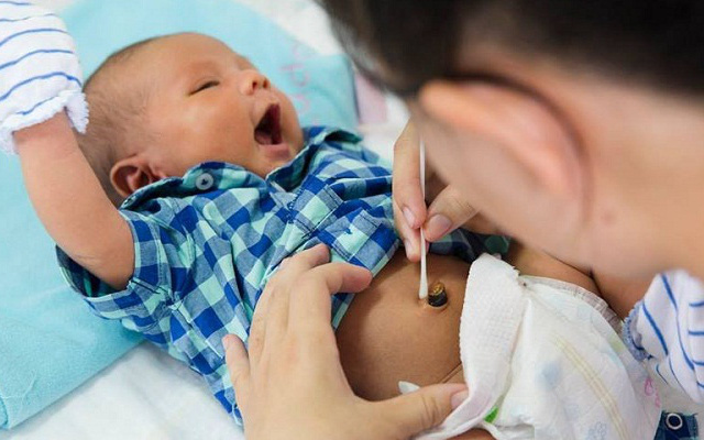 Không nên bôi thuốc lạ lên rốn của bé