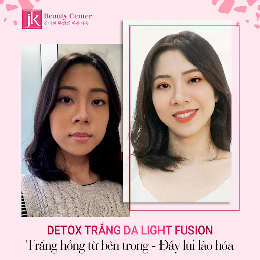 Chị Trang trước và sau khi thực hiện Detox thải độc trắng da- Light Fusion