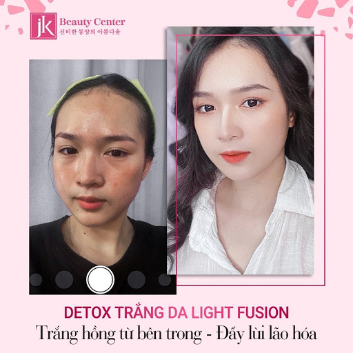 Sự khác biệt rõ rệt về làn da của chị Mai Ngọc sau khi detox thải độc trắng da- Light Fusion