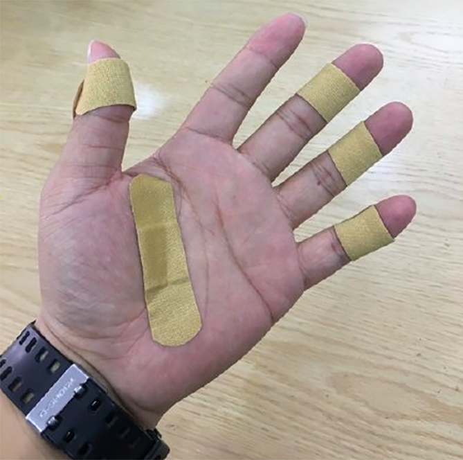 Trước đó, mạng xã hội Trung cũng từng xôn xao viền iPhone 12 làm trầy xước da tay vì cạnh sắc bén