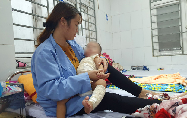 Bé trai bị hoại tử da sau 3 ngày chữa bỏng bằng thuốc của thầy lang.