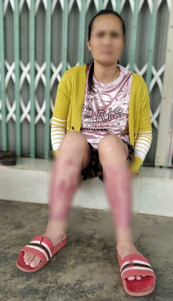 Bà mẹ trẻ không ngại hi sinh thân thể cứu con. Ảnh: Thanh niên